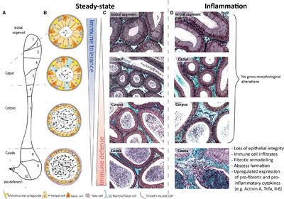 Differential Immune Response to Infection and Acute Inflammation Along the Epididymis